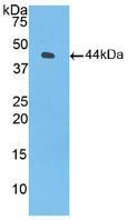 半胱氨酸蛋白酶抑制剂A(CSTA)多克隆抗体