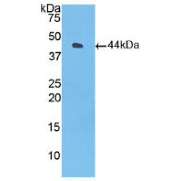 半胱氨酸蛋白酶抑制剂A(CSTA)多克隆抗体