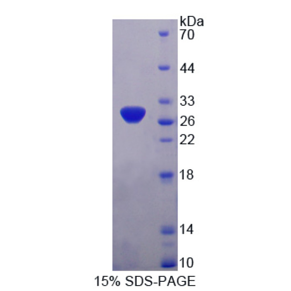 Dickkopf相关蛋白2(DKK2)重组蛋白(多属种)