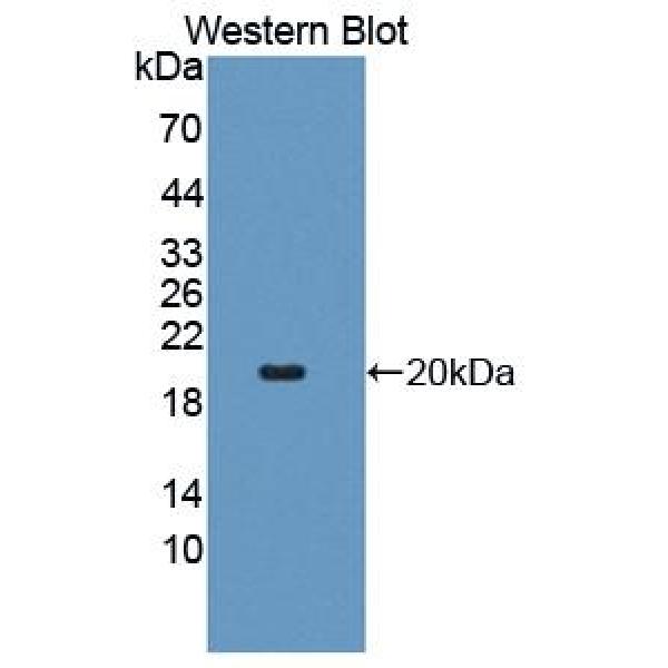 安眠蛋白1β(MEP1b)多克隆抗体