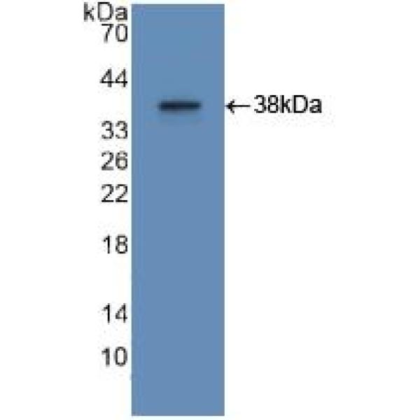 维生素D受体(VDR)多克隆抗体