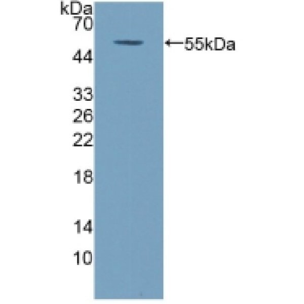 含C2钙依赖型域蛋白3(C2CD3)多克隆抗体