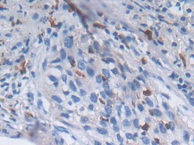 甲状腺结合球蛋白(TBG)多克隆抗体
