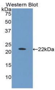 蛋白激酶C&#948;(PKCd)多克隆抗体