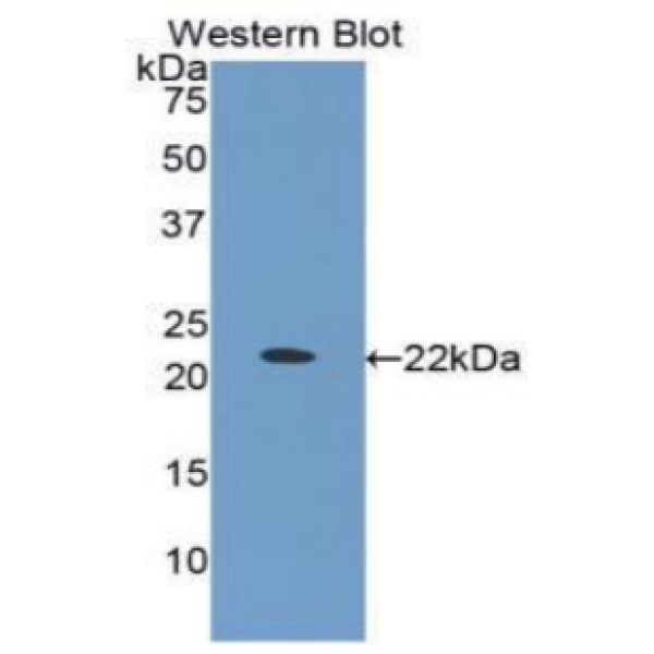 蛋白激酶Cδ(PKCd)多克隆抗体