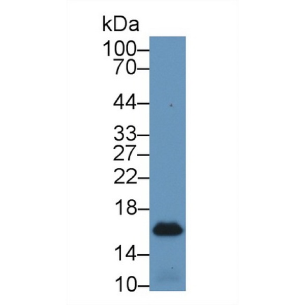 蛋白激酶R(PKR)多克隆抗体