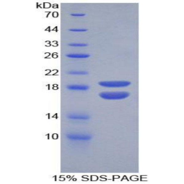 泛素特异性肽酶7(USP7)重组蛋白(多属种)