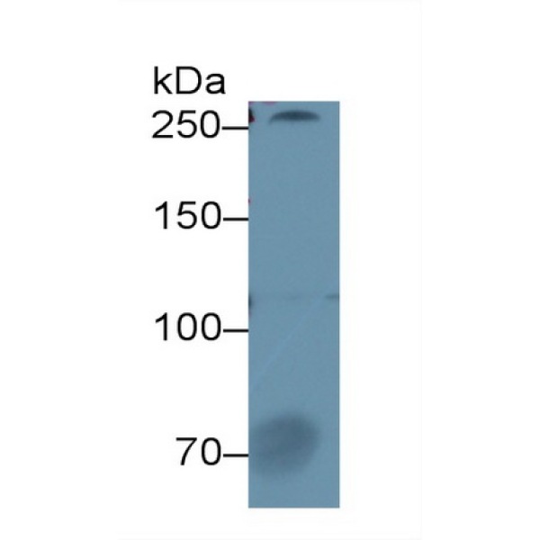 角蛋白1(CK1)多克隆抗体