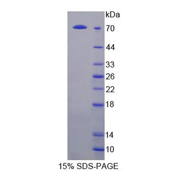 酪蛋白激酶1δ(CSNK1d)重组蛋白(多属种)