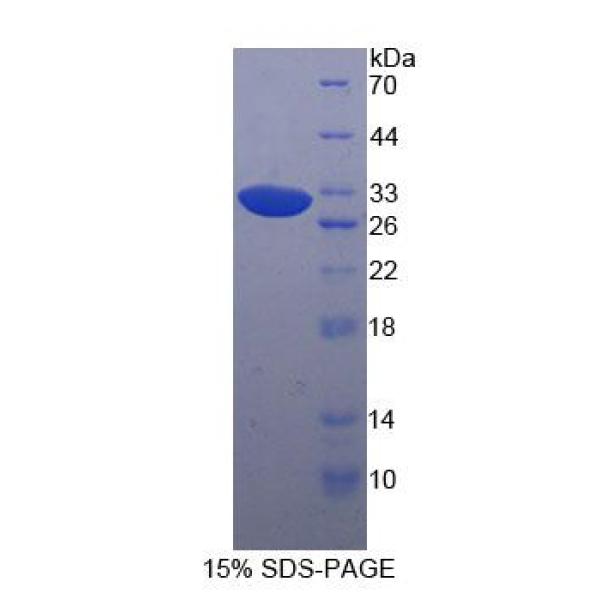 白介素1受体关联激酶3(IRAK3)重组蛋白(多属种)