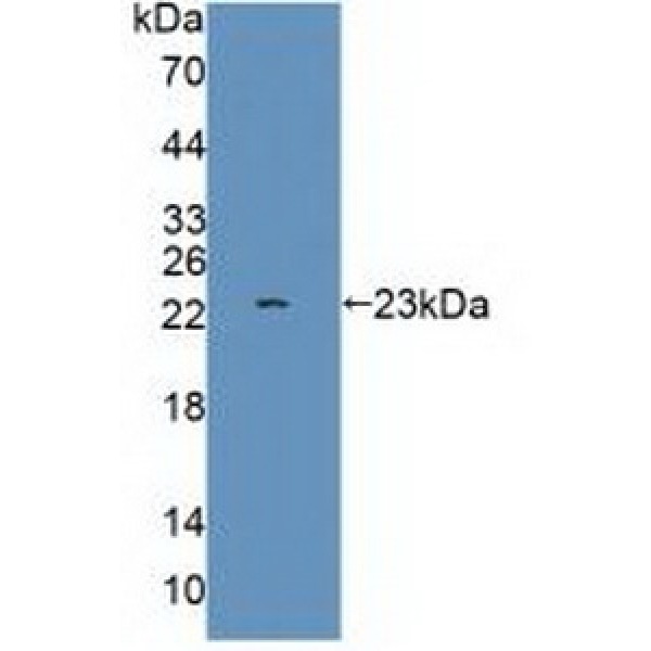 肿瘤蛋白p53(P53)多克隆抗体