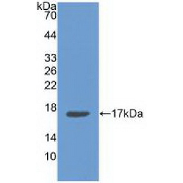 磷酸烯醇式丙酮酸羧激酶1(PCK1)多克隆抗体