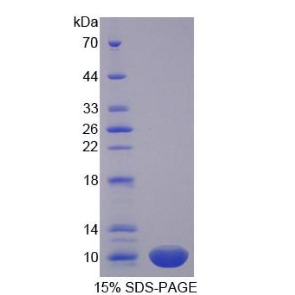 酰基辅酶A合成酶中链家族成员1(ACSM1)重组蛋白(多属种)