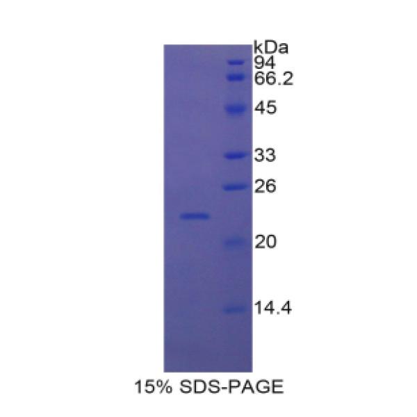 Smad同源物5(Smad5)重组蛋白(多属种)