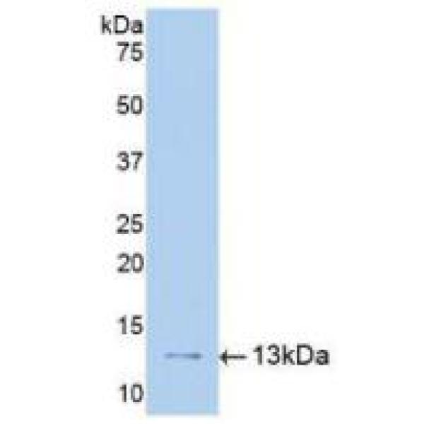 激肽释放酶9(KLK9)多克隆抗体