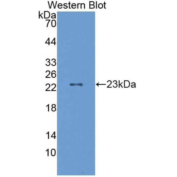 GRB2关联结合蛋白3(GAB3)多克隆抗体