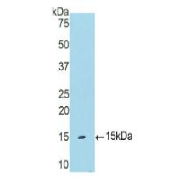 脱氧核糖核酸酶Ⅰ样2(DNASE1L2)多克隆抗体