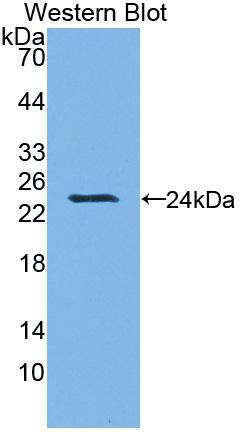 脂联素受体2(ADIPOR2)多克隆抗体