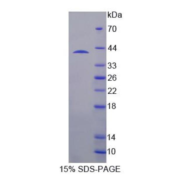 杀伤细胞凝集素样受体亚家族D成员1(KLRD1)重组蛋白(多属种)