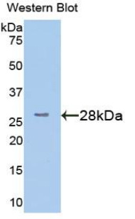 半乳糖凝集素7(GAL7)多克隆抗体