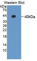 Ⅳ型胶原&#945;1(COL4a1)多克隆抗体