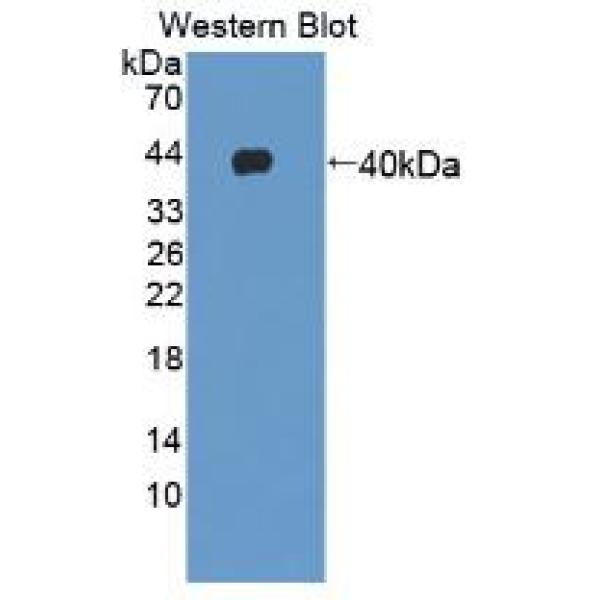 Ⅳ型胶原α1(COL4a1)多克隆抗体