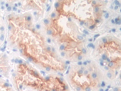 白介素23&#945;(IL23a)多克隆抗体