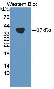 水通道蛋白5(AQP5)多克隆抗体