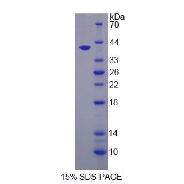 桥粒芯胶粘蛋白2(DSC2)重组蛋白(多属种)