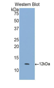 视黄醇结合蛋白3(RBP3)多克隆抗体