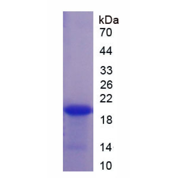 黑色素瘤抗原家族A1(MAGEA1)重组蛋白(多属种)