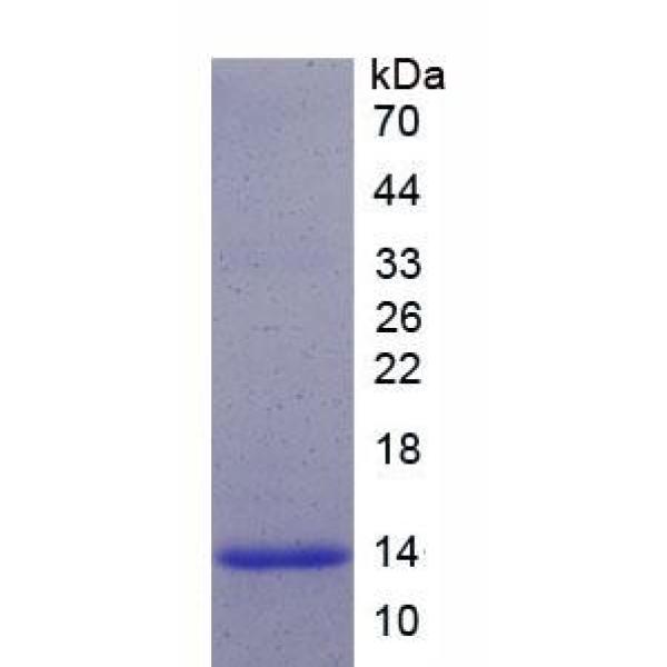 τ-蛋白激酶1(tPK1)重组蛋白(多属种)