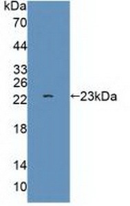 尼克酰胺腺嘌呤二核苷酸磷酸氧化酶1(NOX1)多克隆抗体