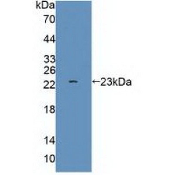 尼克酰胺腺嘌呤二核苷酸磷酸氧化酶1(NOX1)多克隆抗体