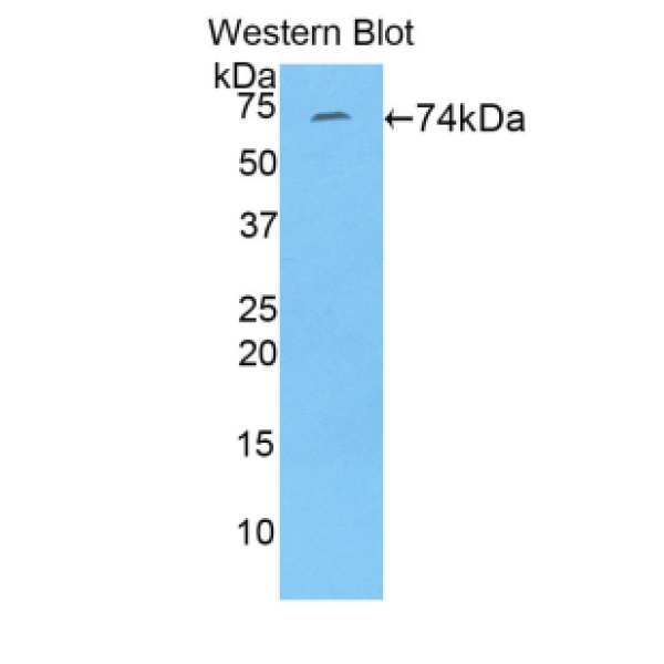 拓扑异构酶Ⅱ(TOP2)多克隆抗体