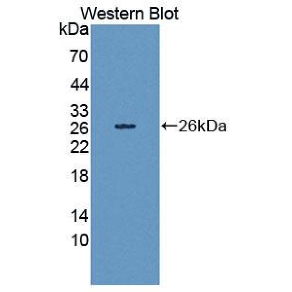 连环蛋白β1(β-catenin)多克隆抗体