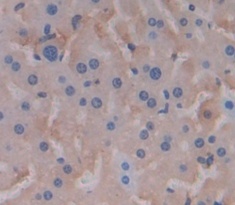 T-细胞激活连接蛋白(LAT)多克隆抗体