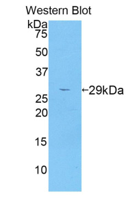 Ⅰ型胶原&#945;1(COL1a1)多克隆抗体
