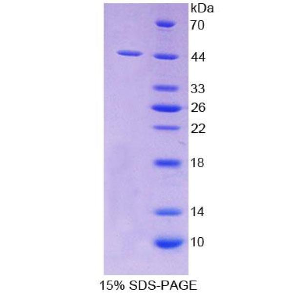 张力蛋白3(TNS3)重组蛋白(多属种)