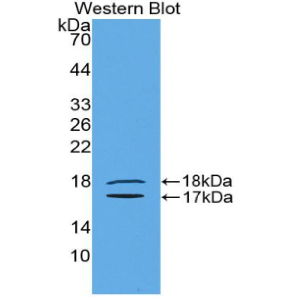 神经激肽B(NKB)多克隆抗体