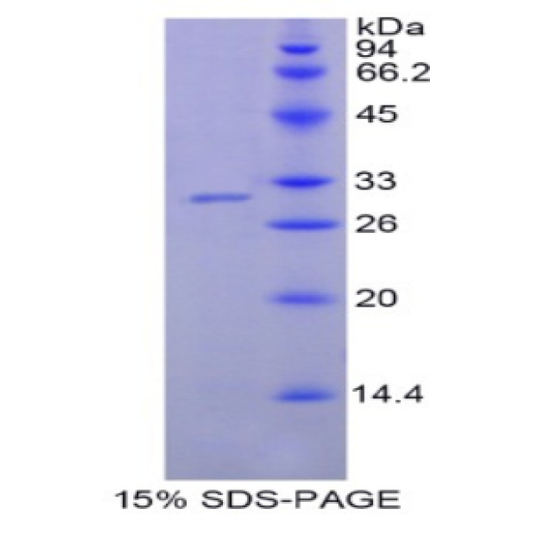 阿米洛利敏感钠离子通道蛋白1β(SCNN1b)重组蛋白(多属种)