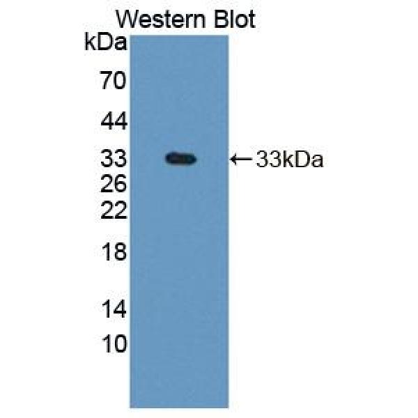 葡萄糖转运蛋白1(GLUT1)多克隆抗体