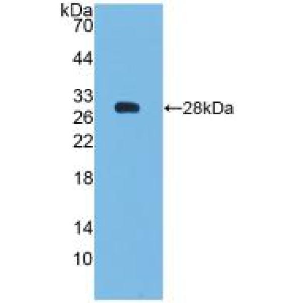 尿黑酸1,2-双加氧酶(HGD)多克隆抗体