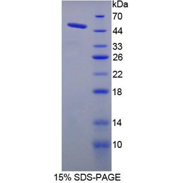 蛋白C抑制因子(PCI)重组蛋白(多属种)