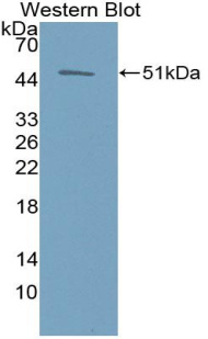 趋化因子C-C-基元受体5(CCR5)多克隆抗体