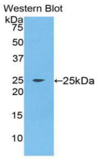 髓样前体细胞抑制因子2(MPIF2)多克隆抗体