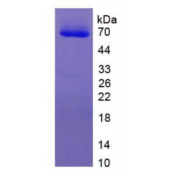 153kDa核孔蛋白(NUP153)重组蛋白(多属种)