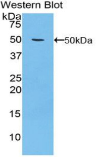 甲状旁腺素受体2(PTHR2)多克隆抗体