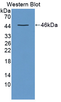 蛛毒素受体2(LPHN2)多克隆抗体