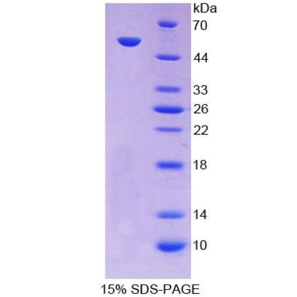 输出蛋白1(XPO1)重组蛋白(多属种)